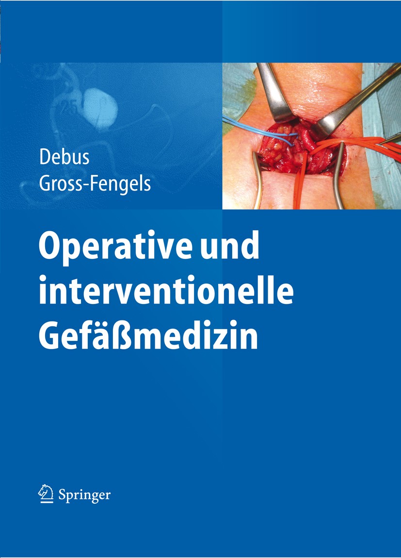 Titlebook: Operative und interventionelle Gefäßmedizin; E. Sebastian Debus,Walter Gross-Fengels Book 20121st edition Springer-Verlag Berlin Heidelber Titlebook: Operative und interventionelle Gefäßmedizin; E. Sebastian Debus,Walter Gross-Fengels Book 20121st edition Springer-Verlag Berlin Heidelber