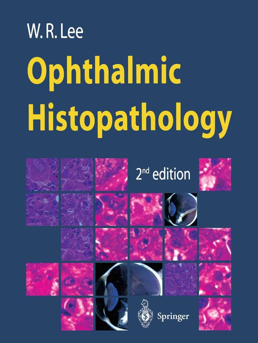 Titlebook: Ophthalmic Histopathology; William R. Lee Book 20022nd edition Springer-Verlag London 2002 Ophthalmology.anatomy.biopsy.cancer.cytopatholo Titlebook: Ophthalmic Histopathology; William R. Lee Book 20022nd edition Springer-Verlag London 2002 Ophthalmology.anatomy.biopsy.cancer.cytopatholo