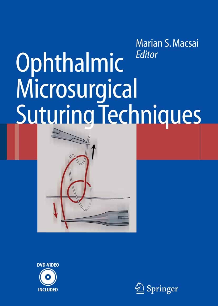 Titlebook: Ophthalmic Microsurgical Suturing Techniques; Marian S. Macsai (Professor and Vice Chair Ophthal Book 2007 Springer-Verlag Berlin Heidelbe Titlebook: Ophthalmic Microsurgical Suturing Techniques; Marian S. Macsai (Professor and Vice Chair Ophthal Book 2007 Springer-Verlag Berlin Heidelbe