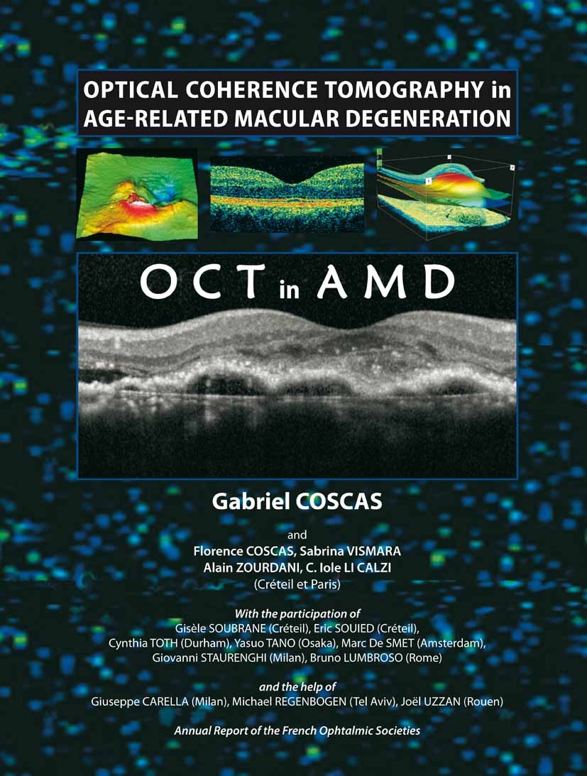 Titlebook: Optical Coherence Tomography in Age-Related Macular Degeneration; Gabriel Coscas,Florence Coscas,C. Iole Calzi Conference proceedings 2009 Titlebook: Optical Coherence Tomography in Age-Related Macular Degeneration; Gabriel Coscas,Florence Coscas,C. Iole Calzi Conference proceedings 2009