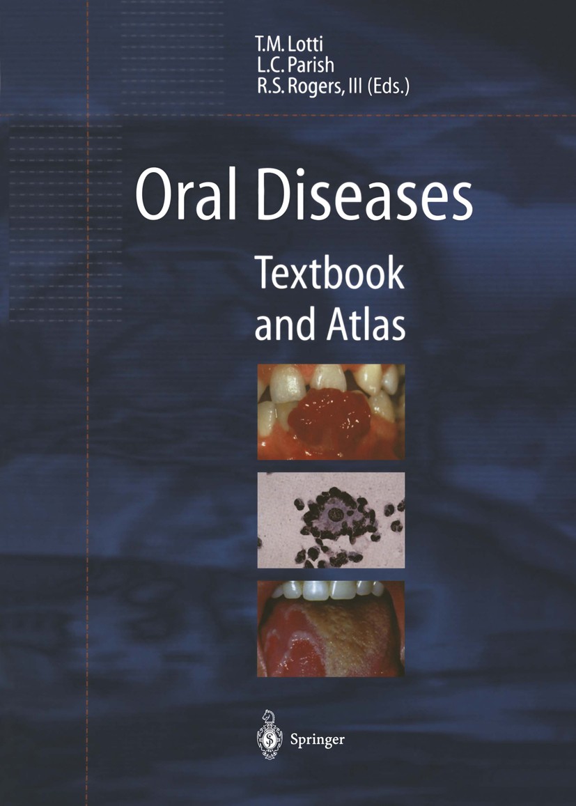 Titlebook: Oral Diseases; Textbook and Atlas Torello M. Lotti,Lawrence Charles Parish,Roy Steel Book 1999 Springer-Verlag Berlin Heidelberg 1999 Derma Titlebook: Oral Diseases; Textbook and Atlas Torello M. Lotti,Lawrence Charles Parish,Roy Steel Book 1999 Springer-Verlag Berlin Heidelberg 1999 Derma