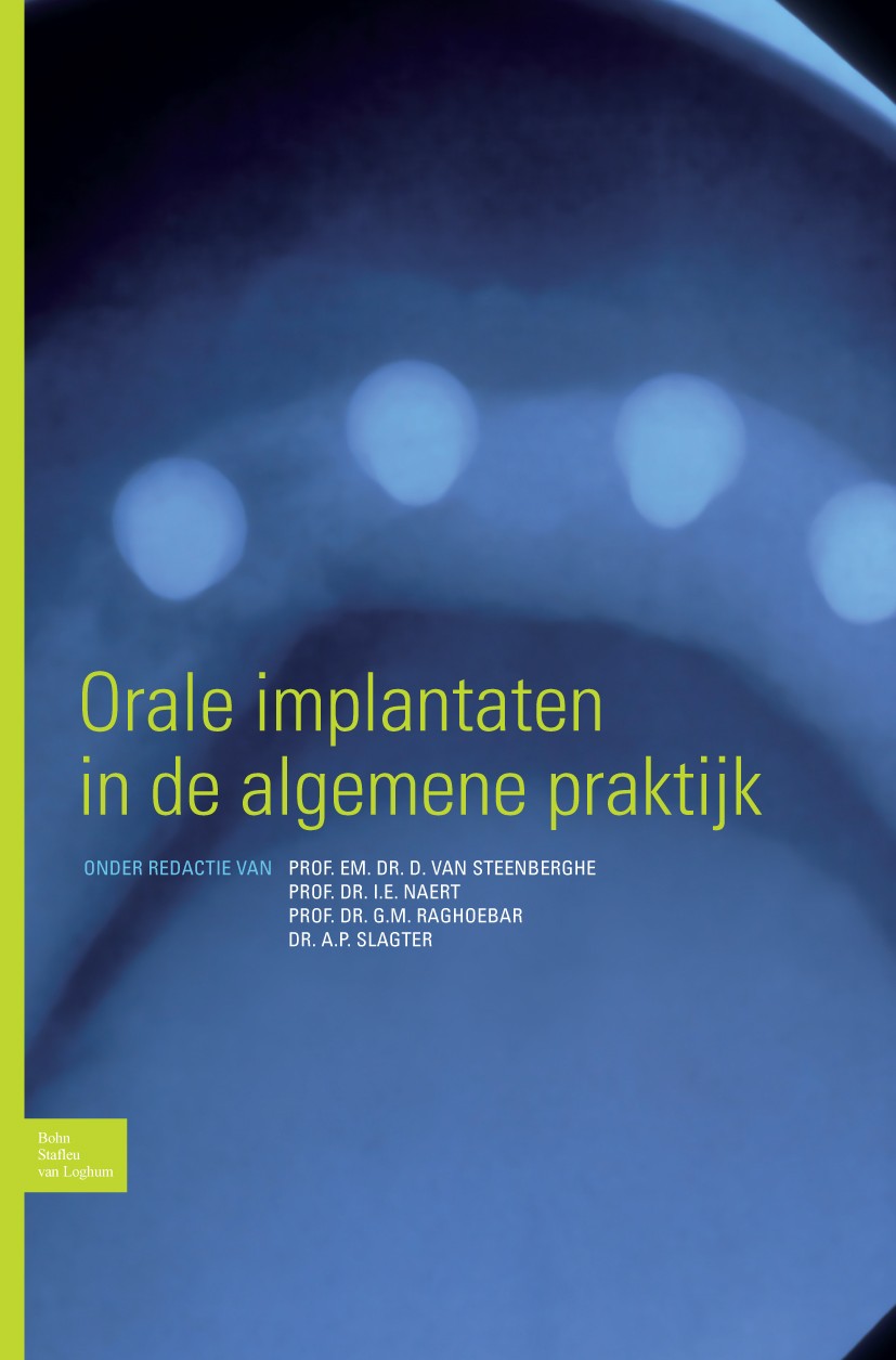 Titlebook: Orale implantaten in de algemene praktijk; D. Steenberghe (Faculteit Geneeskunde),I.E. Naert Book 2008Latest edition Bohn Stafleu van Log Titlebook: Orale implantaten in de algemene praktijk; D. Steenberghe (Faculteit Geneeskunde),I.E. Naert Book 2008Latest edition Bohn Stafleu van Log