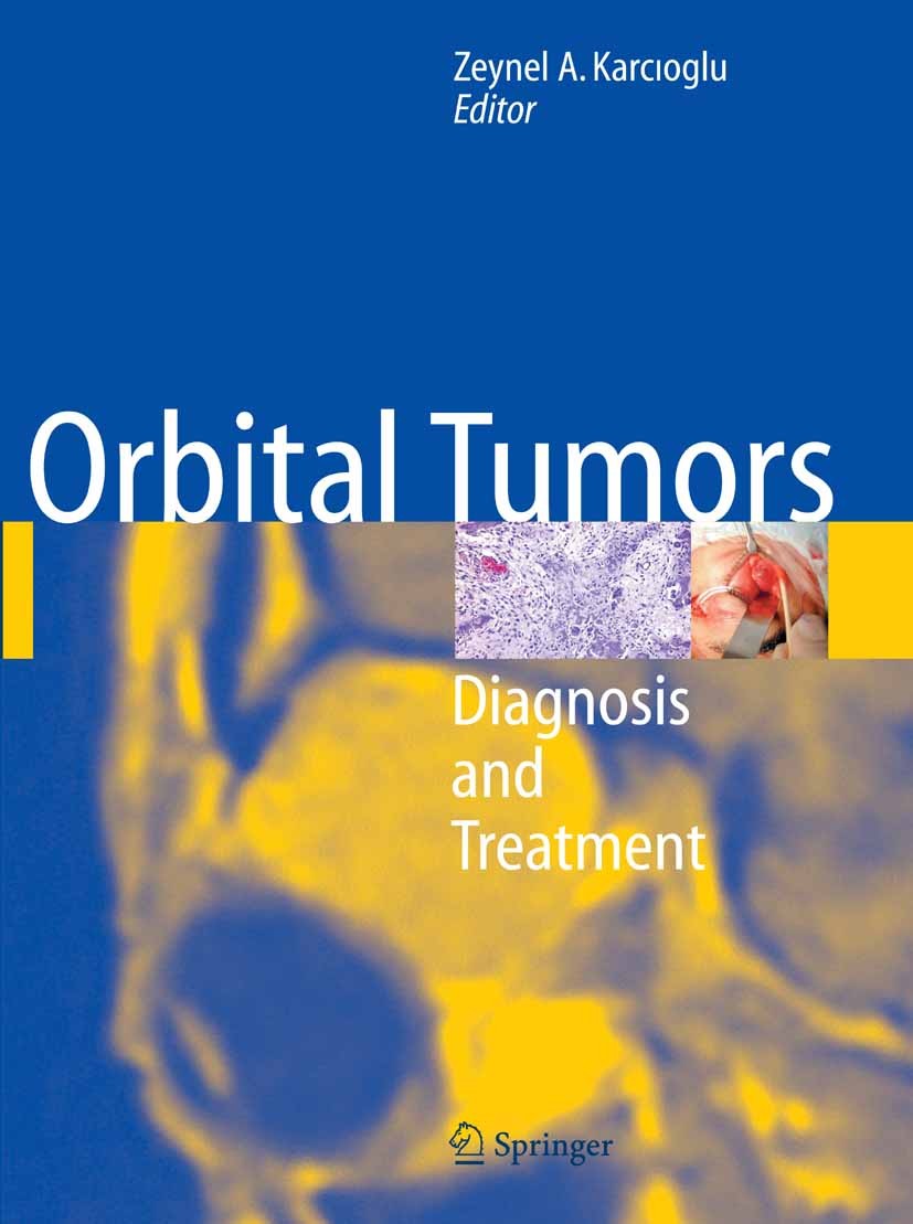 Titlebook: Orbital Tumors; Diagnosis and Treatm Zeynel A. Karcioglu Book 20051st edition Springer-Verlag New York 2005 Staging.biopsy.imaging.imaging Titlebook: Orbital Tumors; Diagnosis and Treatm Zeynel A. Karcioglu Book 20051st edition Springer-Verlag New York 2005 Staging.biopsy.imaging.imaging