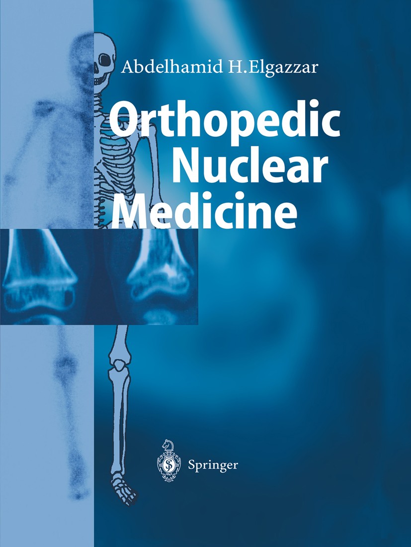 Titlebook: Orthopedic Nuclear Medicine; Abdelhamid H. Elgazzar Book 20041st edition Springer-Verlag Berlin Heidelberg 2004 Bone.Imaging.Internist.Ort Titlebook: Orthopedic Nuclear Medicine; Abdelhamid H. Elgazzar Book 20041st edition Springer-Verlag Berlin Heidelberg 2004 Bone.Imaging.Internist.Ort