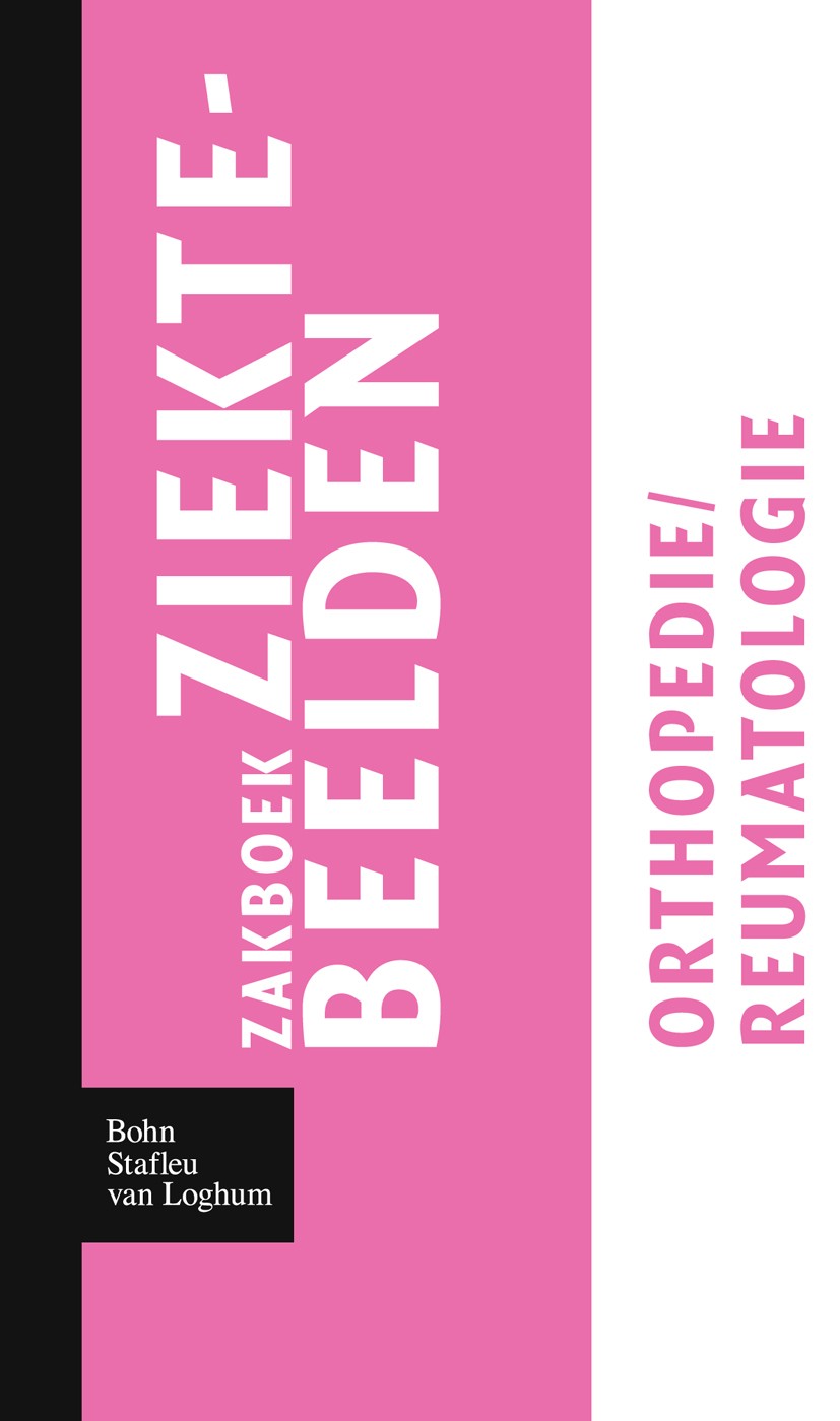 Titlebook: Zakboek ziektebeelden Orthopedie / Reumatologie; Karin Linden Book 2009Latest edition Bohn Stafleu van Loghum 2009 Titlebook: Zakboek ziektebeelden Orthopedie / Reumatologie; Karin Linden Book 2009Latest edition Bohn Stafleu van Loghum 2009