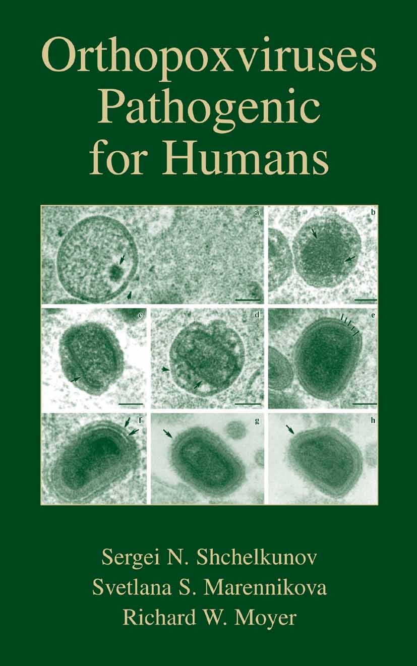 Titlebook: Orthopoxviruses Pathogenic for Humans; S. N. Shchelkunov,S. S. Marennikova,R. W. Moyer Book 2005 Springer-Verlag US 2005 Public Health.Rad Titlebook: Orthopoxviruses Pathogenic for Humans; S. N. Shchelkunov,S. S. Marennikova,R. W. Moyer Book 2005 Springer-Verlag US 2005 Public Health.Rad