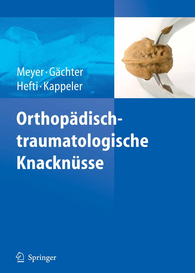 Titlebook: Orthopädisch-traumatologische Knacknüsse; Rainer-Peter Meyer,André Gächter,U. Kappeler Book 2007 Springer-Verlag Berlin Heidelberg 2007 Ar Titlebook: Orthopädisch-traumatologische Knacknüsse; Rainer-Peter Meyer,André Gächter,U. Kappeler Book 2007 Springer-Verlag Berlin Heidelberg 2007 Ar