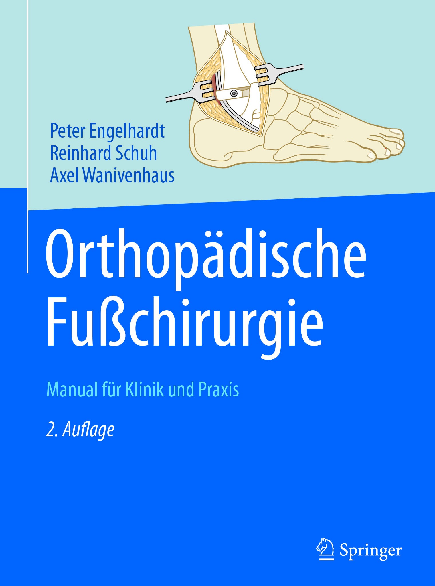 Titlebook: Orthopädische Fußchirurgie; Manual für Klinik un Peter Engelhardt,Reinhard Schuh,Axel Wanivenhaus Book 2018Latest edition Springer-Verlag G Titlebook: Orthopädische Fußchirurgie; Manual für Klinik un Peter Engelhardt,Reinhard Schuh,Axel Wanivenhaus Book 2018Latest edition Springer-Verlag G