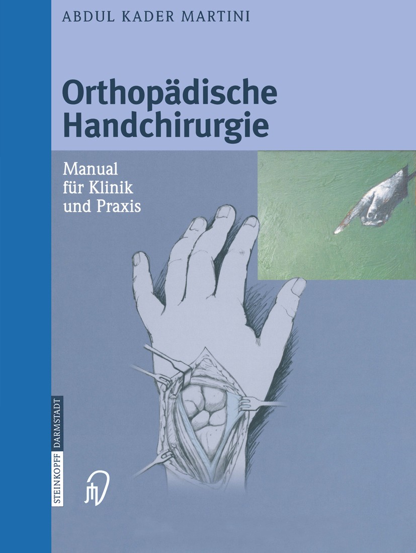 Titlebook: Orthopädische Handchirurgie; Manual für Klinik un Abdul Kader Martini Book 20041st edition Steinkopff-Verlag Darmstadt 2004 Amputation.Chir Titlebook: Orthopädische Handchirurgie; Manual für Klinik un Abdul Kader Martini Book 20041st edition Steinkopff-Verlag Darmstadt 2004 Amputation.Chir