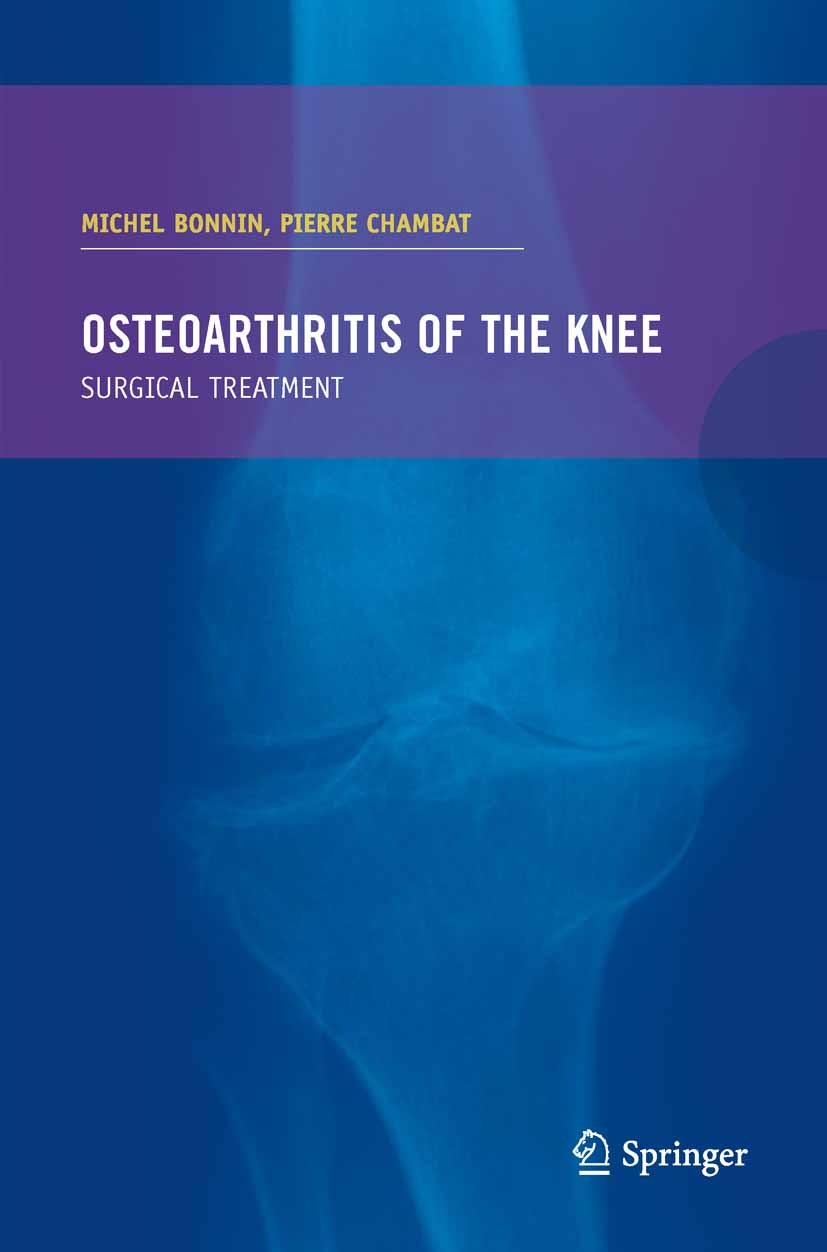 Titlebook: Osteoarthritis of the knee; Michel Bonnin,Pierre Chambat Book 2008 Springer-Verlag Paris 2008 Arthritis.arthroplasty.bone.cartilage.compli Titlebook: Osteoarthritis of the knee; Michel Bonnin,Pierre Chambat Book 2008 Springer-Verlag Paris 2008 Arthritis.arthroplasty.bone.cartilage.compli