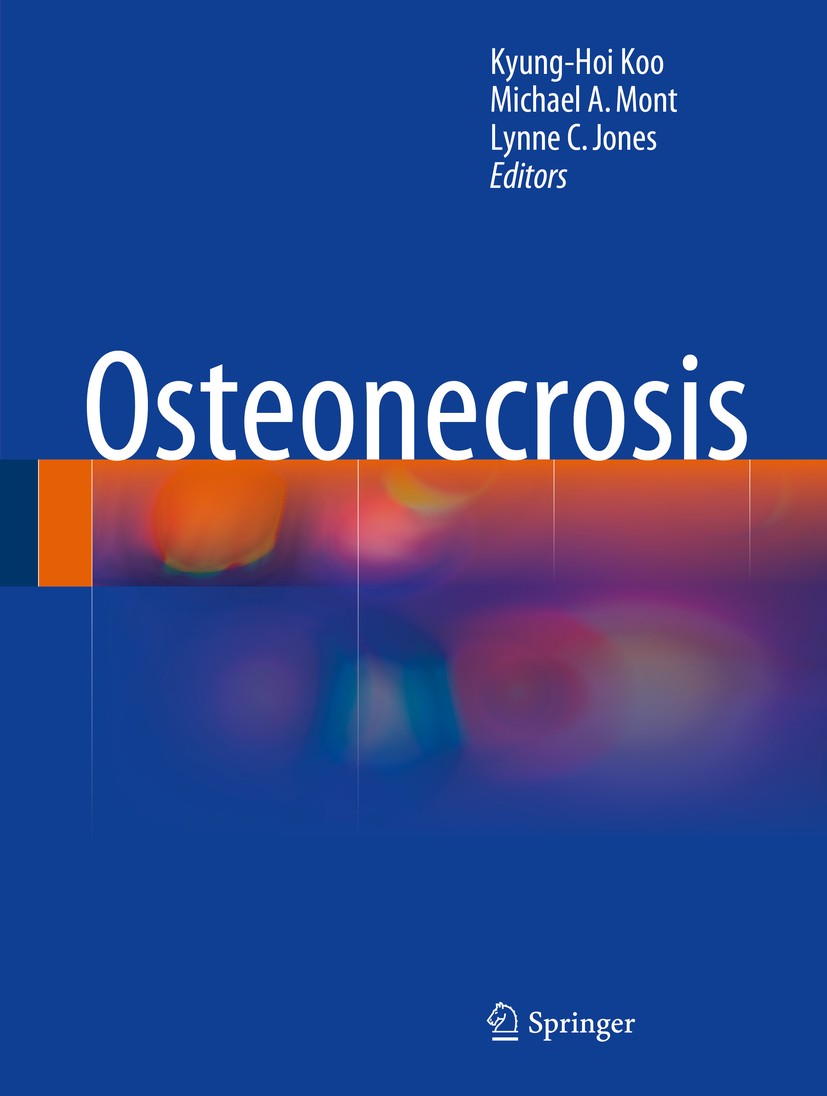 Titlebook: Osteonecrosis; Kyung-Hoi Koo,Michael A. Mont,Lynne C. Jones Book 20141st edition Springer-Verlag Berlin Heidelberg 2014 Osteonecrosis.diag Titlebook: Osteonecrosis; Kyung-Hoi Koo,Michael A. Mont,Lynne C. Jones Book 20141st edition Springer-Verlag Berlin Heidelberg 2014 Osteonecrosis.diag