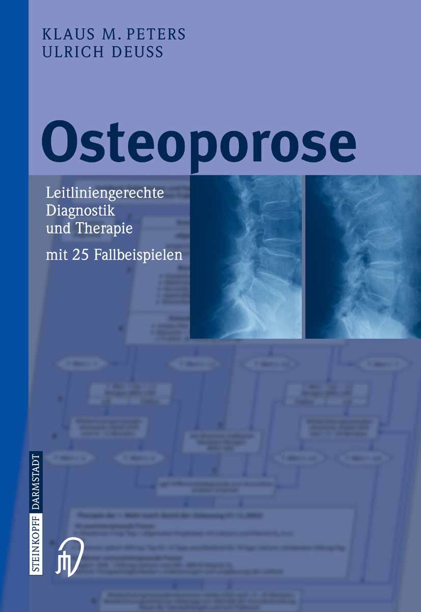 Titlebook: Osteoporose; Leitliniengerechte D Klaus M. Peters,Ulrich Deuss Book 2005 Steinkopff-Verlag Darmstadt 2005 Fraktur.Knochen.Osteologie.Osteop Titlebook: Osteoporose; Leitliniengerechte D Klaus M. Peters,Ulrich Deuss Book 2005 Steinkopff-Verlag Darmstadt 2005 Fraktur.Knochen.Osteologie.Osteop