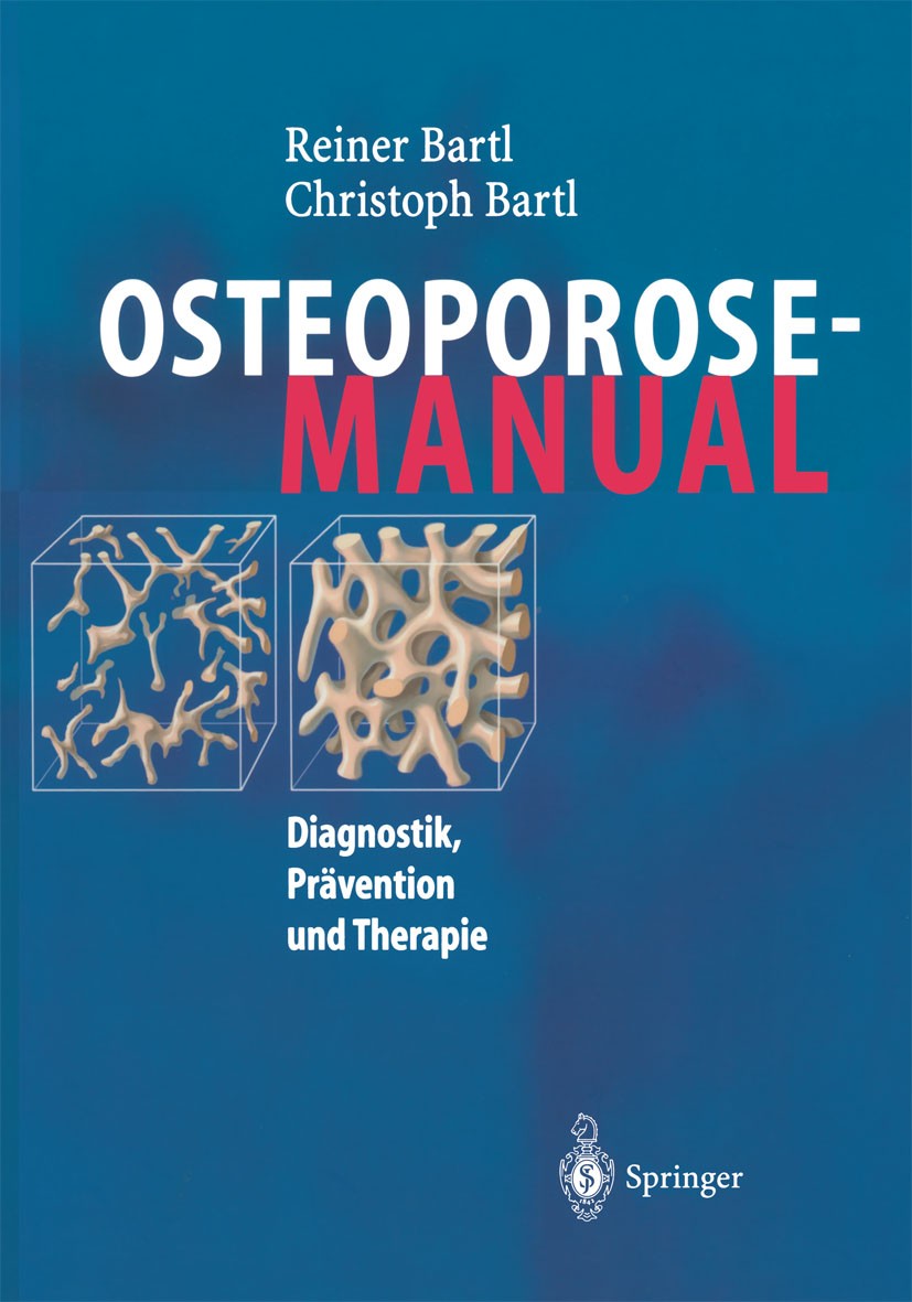 Titlebook: Osteoporose-Manual; Diagnostik, Präventi Reiner Bartl,Christoph Bartl Book 20041st edition Springer-Verlag Berlin Heidelberg 2004 Behandlun Titlebook: Osteoporose-Manual; Diagnostik, Präventi Reiner Bartl,Christoph Bartl Book 20041st edition Springer-Verlag Berlin Heidelberg 2004 Behandlun