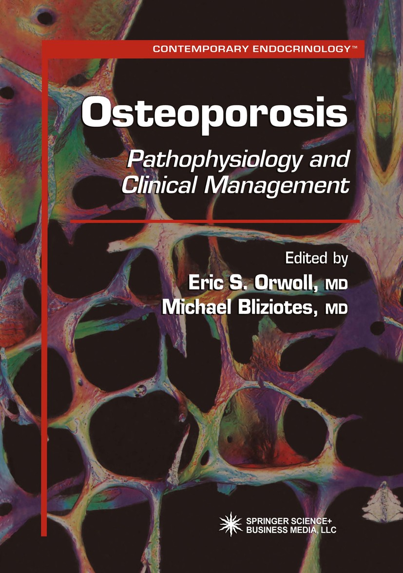 Titlebook: Osteoporosis; Pathophysiology and Eric S. Orwoll,Michael Bliziotes Book 20031st edition Springer Science+Business Media New York 2003 Vita Titlebook: Osteoporosis; Pathophysiology and Eric S. Orwoll,Michael Bliziotes Book 20031st edition Springer Science+Business Media New York 2003 Vita