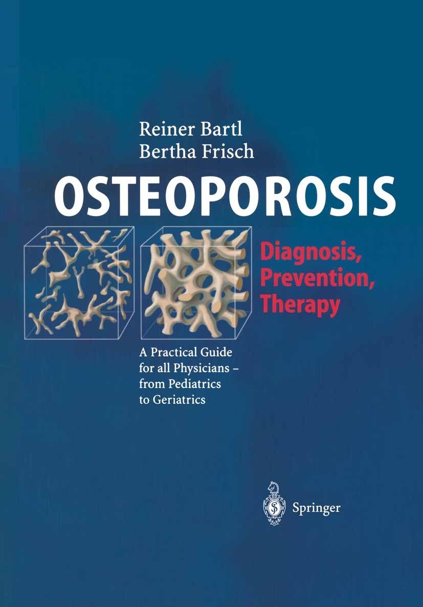 Titlebook: OSTEOPOROSIS; Diagnosis, Preventio Reiner Bartl,Bertha Frisch Book 20041st edition Springer Berlin Heidelberg 2004 Bisphosphonates.Bone Den Titlebook: OSTEOPOROSIS; Diagnosis, Preventio Reiner Bartl,Bertha Frisch Book 20041st edition Springer Berlin Heidelberg 2004 Bisphosphonates.Bone Den