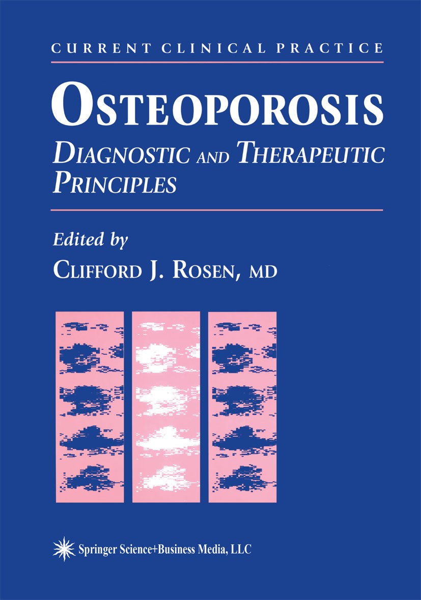 Titlebook: Osteoporosis; Diagnostic and Thera Clifford J. Rosen Book 1996 Springer Science+Business Media New York 1996 Vitamin D.bone.fracture.glucoc Titlebook: Osteoporosis; Diagnostic and Thera Clifford J. Rosen Book 1996 Springer Science+Business Media New York 1996 Vitamin D.bone.fracture.glucoc