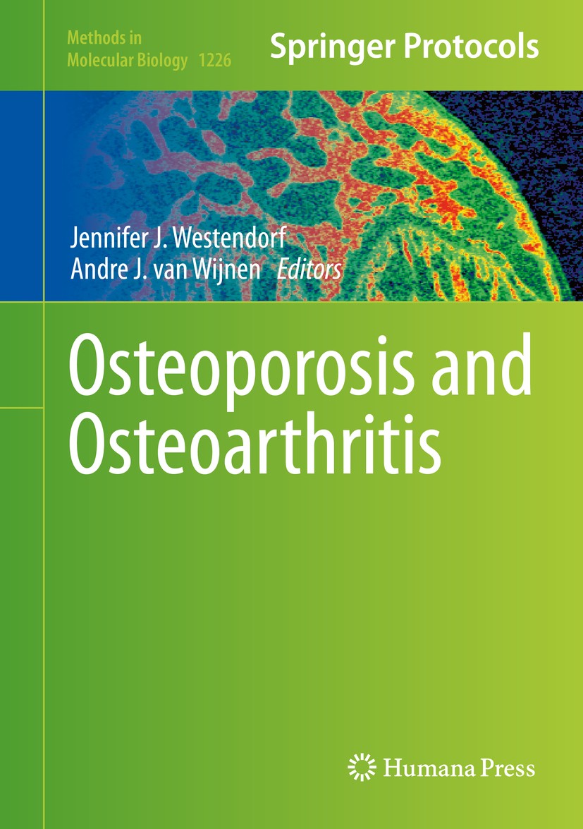 Titlebook: Osteoporosis and Osteoarthritis; Jennifer J. Westendorf,Andre J. van Wijnen Book 2015 Springer Science+Business Media. New York 2015 artic Titlebook: Osteoporosis and Osteoarthritis; Jennifer J. Westendorf,Andre J. van Wijnen Book 2015 Springer Science+Business Media. New York 2015 artic