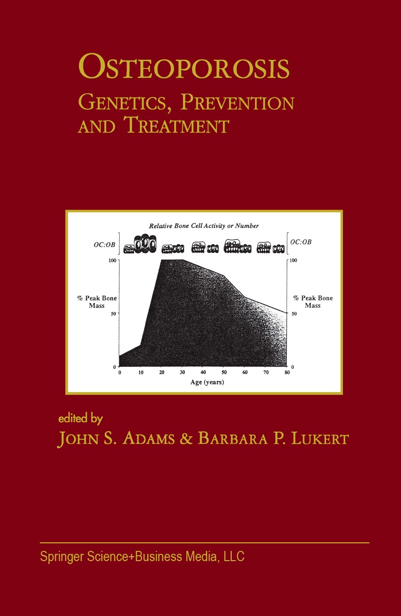 Titlebook: Osteoporosis: Genetics, Prevention and Treatment; Genetics, Prevention John S. Adams,Barbara P. Lukert Book 1999 Springer Science+Business Titlebook: Osteoporosis: Genetics, Prevention and Treatment; Genetics, Prevention John S. Adams,Barbara P. Lukert Book 1999 Springer Science+Business