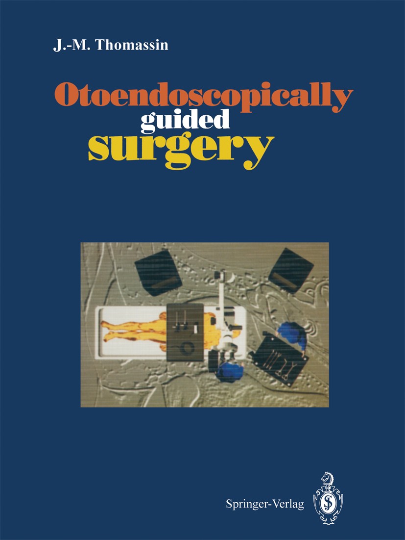 Titlebook: Otoendoscopically guided surgery; J.-M. Thomassin Book 1994 Springer-Verlag France 1994 anatomy.cholesteatoma.ear.endoscopic guided surger Titlebook: Otoendoscopically guided surgery; J.-M. Thomassin Book 1994 Springer-Verlag France 1994 anatomy.cholesteatoma.ear.endoscopic guided surger
