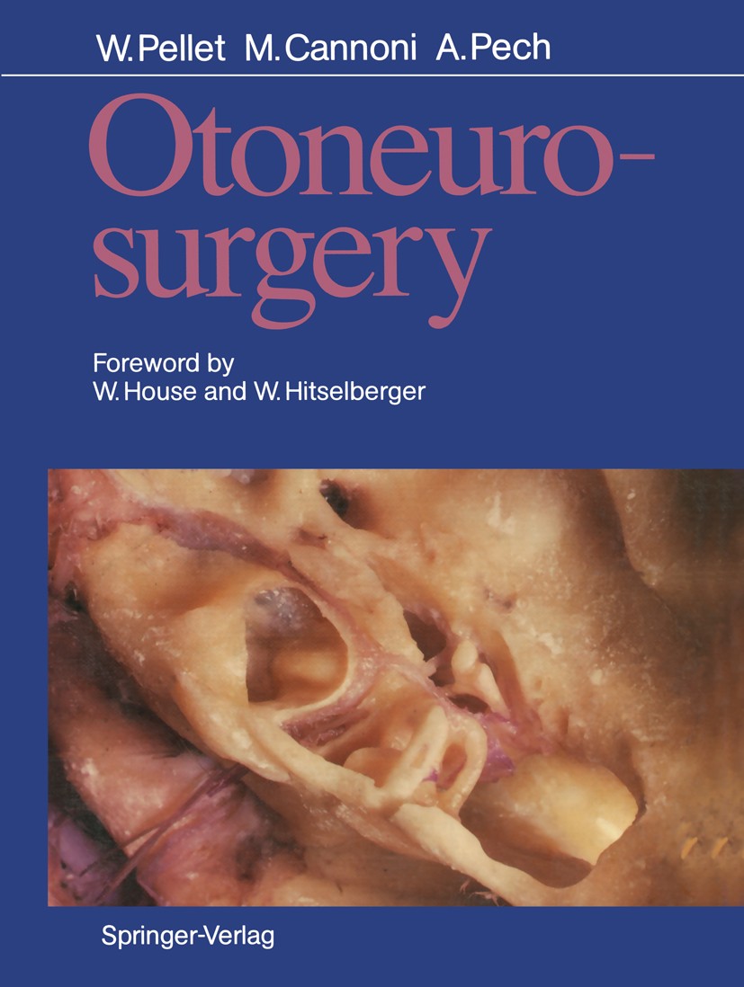 Titlebook: Otoneurosurgery; William Pellet,Maurice Cannoni,André Pech Book 1990 Springer-Verlag Berlin Heidelberg 1990 Felsenbein.Glomangiom.Menigiom Titlebook: Otoneurosurgery; William Pellet,Maurice Cannoni,André Pech Book 1990 Springer-Verlag Berlin Heidelberg 1990 Felsenbein.Glomangiom.Menigiom