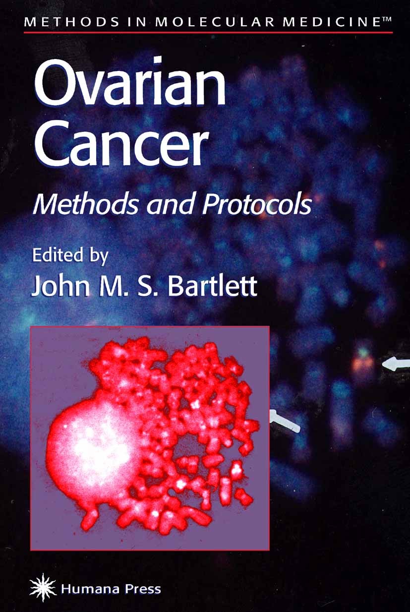 Titlebook: Ovarian Cancer; Methods and Protocol John M. S. Bartlett Book 2001 Humana Press 2001 Titlebook: Ovarian Cancer; Methods and Protocol John M. S. Bartlett Book 2001 Humana Press 2001