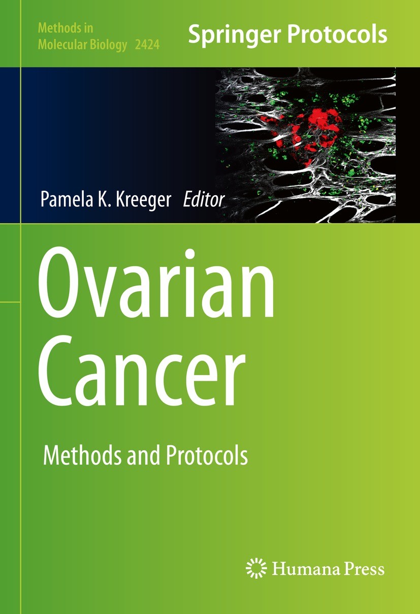 Titlebook: Ovarian Cancer; Methods and Protocol Pamela K. Kreeger Book 2022 The Editor(s) (if applicable) and The Author(s), under exclusive license t Titlebook: Ovarian Cancer; Methods and Protocol Pamela K. Kreeger Book 2022 The Editor(s) (if applicable) and The Author(s), under exclusive license t