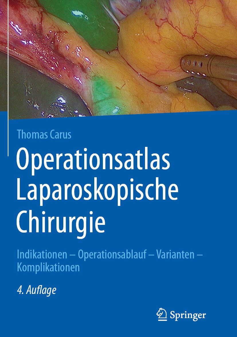 Titlebook: Operationsatlas Laparoskopische Chirurgie; Indikationen - Opera Thomas Carus Book 2024Latest edition Springer-Verlag GmbH Deutschland, ein Titlebook: Operationsatlas Laparoskopische Chirurgie; Indikationen - Opera Thomas Carus Book 2024Latest edition Springer-Verlag GmbH Deutschland, ein