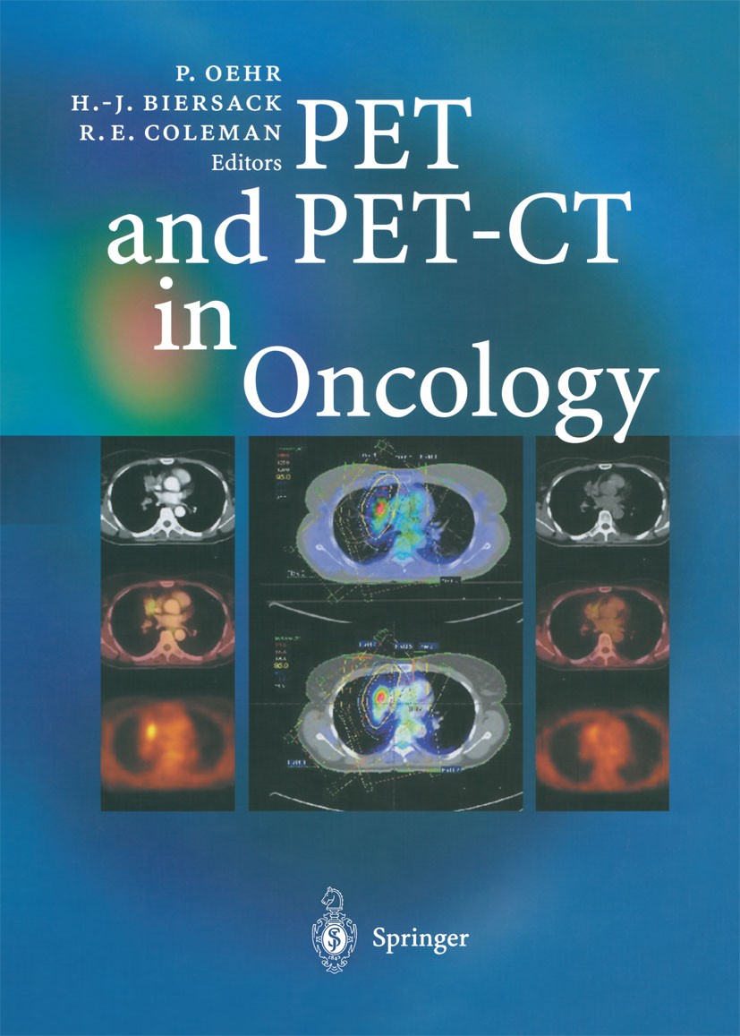 Titlebook: PET and PET-CT in Oncology; Peter Oehr,Hans-Jürgen Biersack,R. Edward Coleman Book 2004 Springer-Verlag Berlin Heidelberg 2004 CT.Cancer.C Titlebook: PET and PET-CT in Oncology; Peter Oehr,Hans-Jürgen Biersack,R. Edward Coleman Book 2004 Springer-Verlag Berlin Heidelberg 2004 CT.Cancer.C