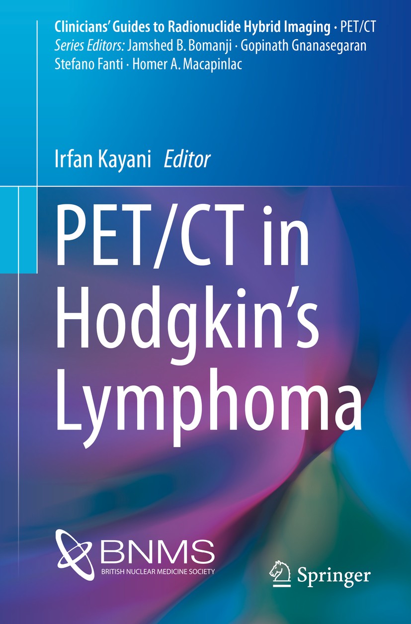 Titlebook: PET/CT in Hodgkin’s Lymphoma; Irfan Kayani Book 2017 Springer International Publishing AG 2017 Lymphoma.PET/CT.18F-FDG.Hybrid Imaging.Canc Titlebook: PET/CT in Hodgkin’s Lymphoma; Irfan Kayani Book 2017 Springer International Publishing AG 2017 Lymphoma.PET/CT.18F-FDG.Hybrid Imaging.Canc