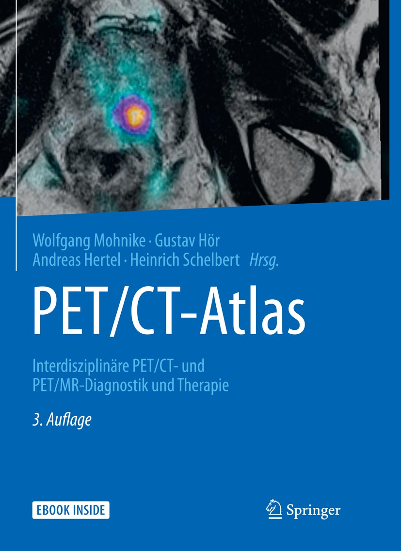 Titlebook: PET/CT-Atlas; Interdisziplinäre PE Wolfgang Mohnike,Gustav Hör,Heinrich Schelbert Book 20163rd edition Springer-Verlag Berlin Heidelberg 20 Titlebook: PET/CT-Atlas; Interdisziplinäre PE Wolfgang Mohnike,Gustav Hör,Heinrich Schelbert Book 20163rd edition Springer-Verlag Berlin Heidelberg 20