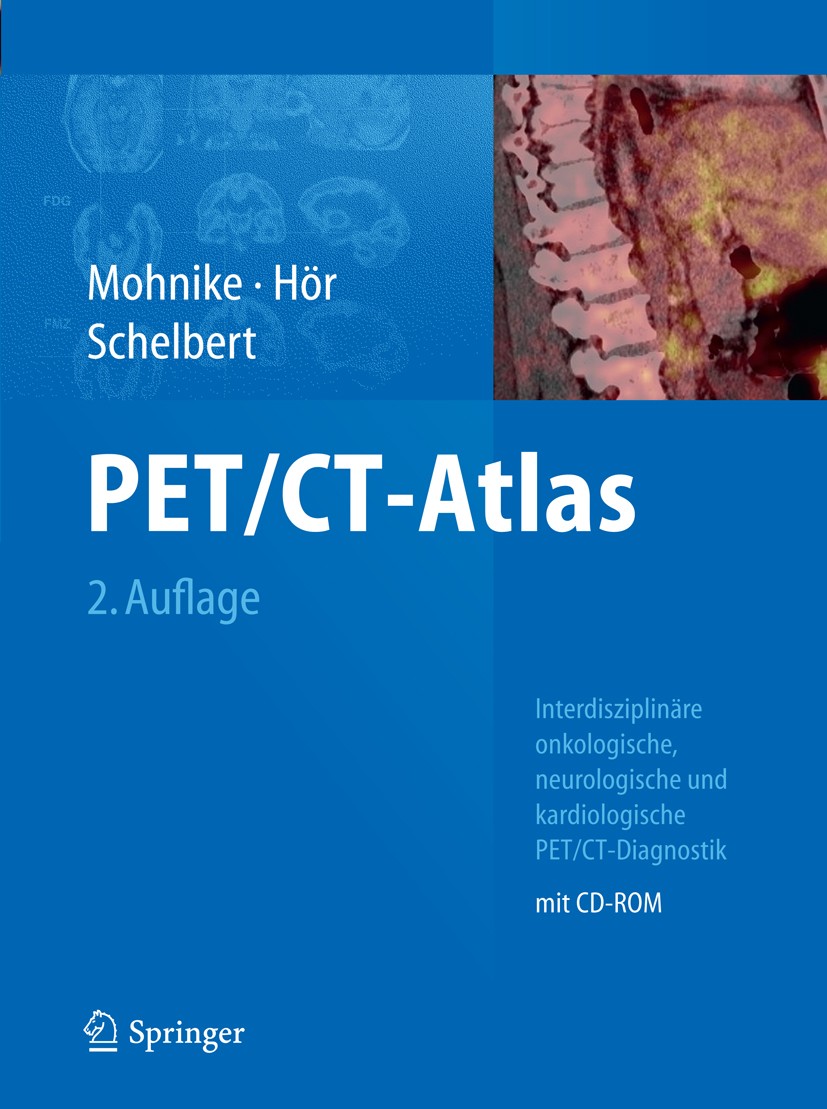 Titlebook: PET/CT-Atlas; Interdisziplinäre on Wolfgang Mohnike,Gustav Hör,Heinrich Schelbert Book May 20112nd edition Springer-Verlag Berlin Heidelber Titlebook: PET/CT-Atlas; Interdisziplinäre on Wolfgang Mohnike,Gustav Hör,Heinrich Schelbert Book May 20112nd edition Springer-Verlag Berlin Heidelber