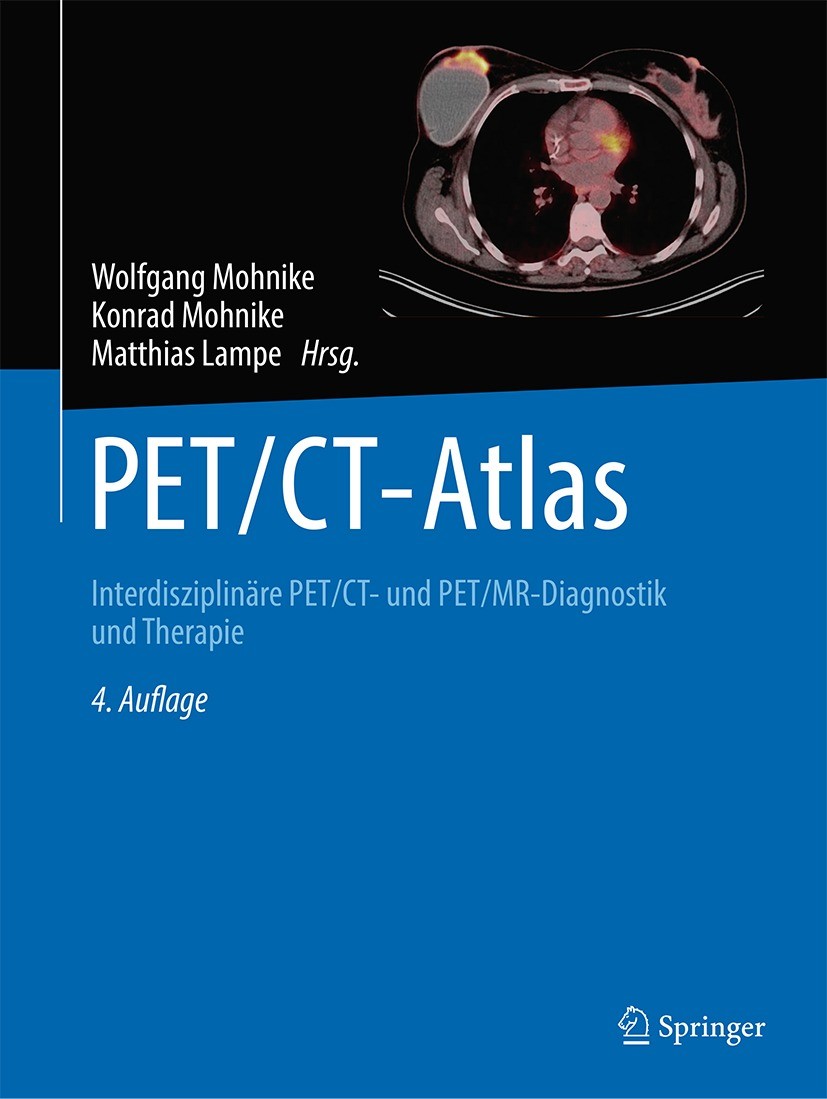 Titlebook: PET/CT-Atlas; Interdisziplinäre PE Wolfgang Mohnike,Konrad Mohnike,Matthias Lampe Book 2024Latest edition Der/die Herausgeber bzw. der/die Titlebook: PET/CT-Atlas; Interdisziplinäre PE Wolfgang Mohnike,Konrad Mohnike,Matthias Lampe Book 2024Latest edition Der/die Herausgeber bzw. der/die