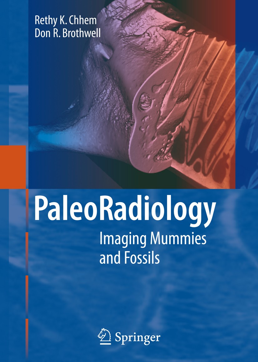 Titlebook: Paleoradiology; Imaging Mummies and Rethy Chhem,Don Brothwell Book 2008 Springer-Verlag Berlin Heidelberg 2008 Bioarchaeology.Computed Tom Titlebook: Paleoradiology; Imaging Mummies and Rethy Chhem,Don Brothwell Book 2008 Springer-Verlag Berlin Heidelberg 2008 Bioarchaeology.Computed Tom