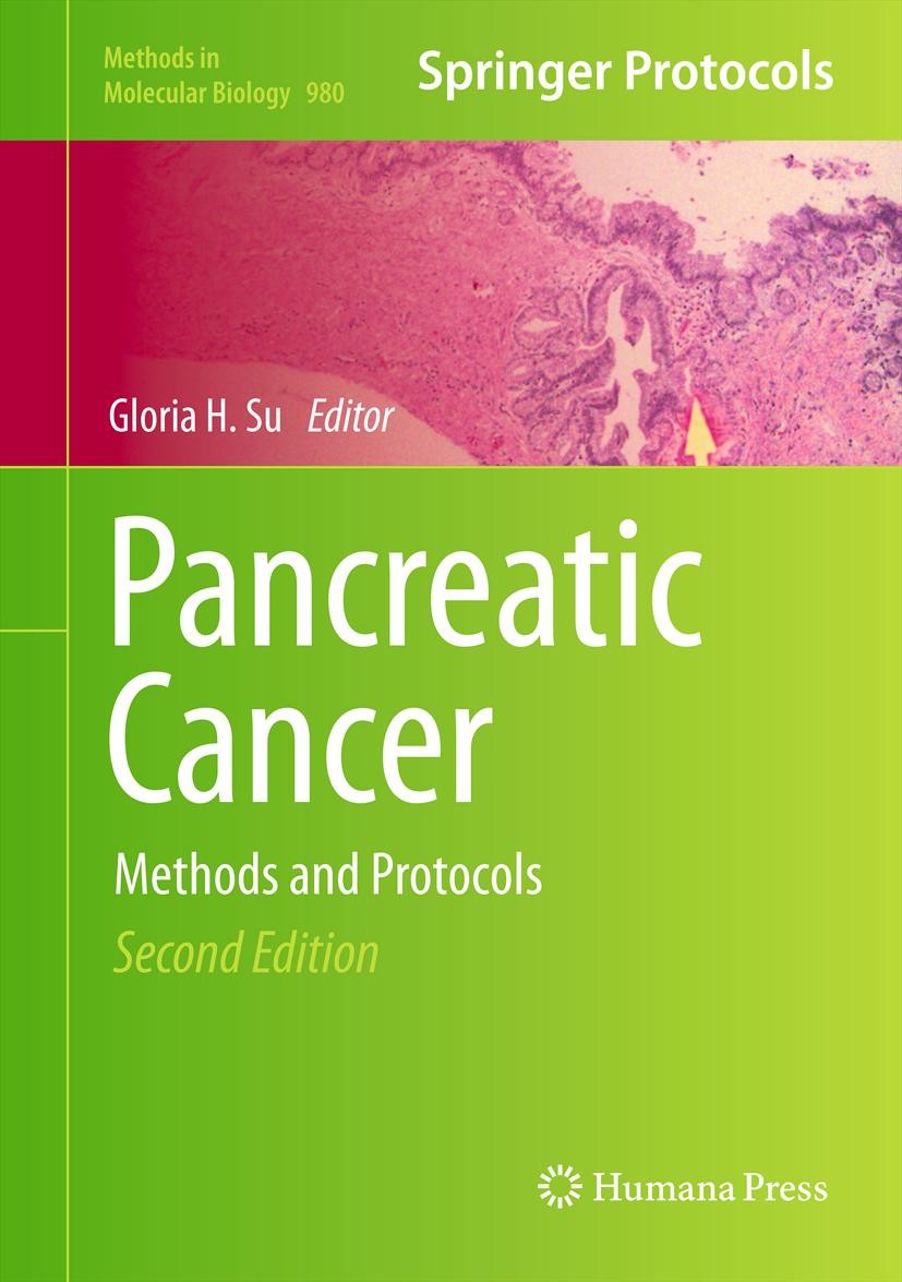 Titlebook: Pancreatic Cancer; Methods and Protocol Gloria H. Su Book 2013Latest edition Springer Science+Business Media, LLC 2013 DNA to protein manip Titlebook: Pancreatic Cancer; Methods and Protocol Gloria H. Su Book 2013Latest edition Springer Science+Business Media, LLC 2013 DNA to protein manip