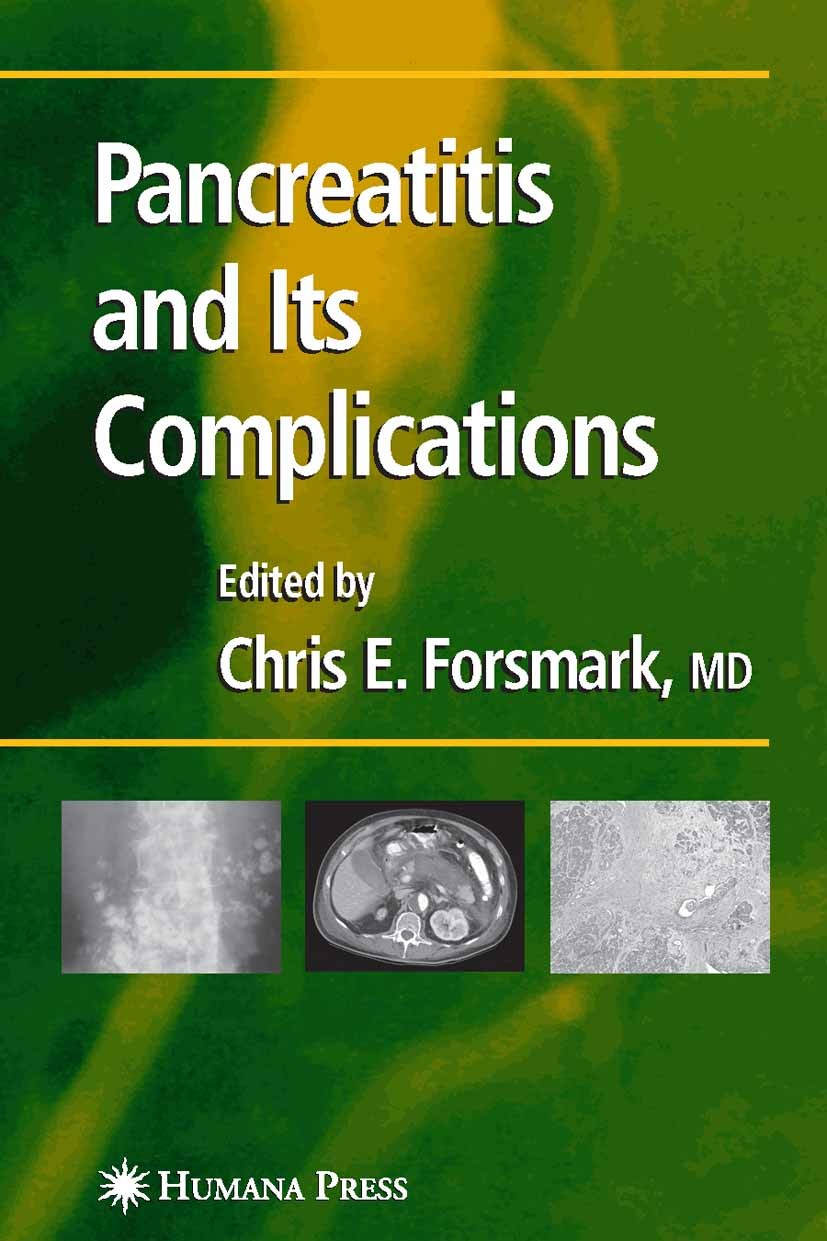 Titlebook: Pancreatitis and Its Complications; Chris E. Forsmark Book 2005 Humana Press 2005 chronic pancreatitis.endoscopy.infection.necrosis.pathop Titlebook: Pancreatitis and Its Complications; Chris E. Forsmark Book 2005 Humana Press 2005 chronic pancreatitis.endoscopy.infection.necrosis.pathop