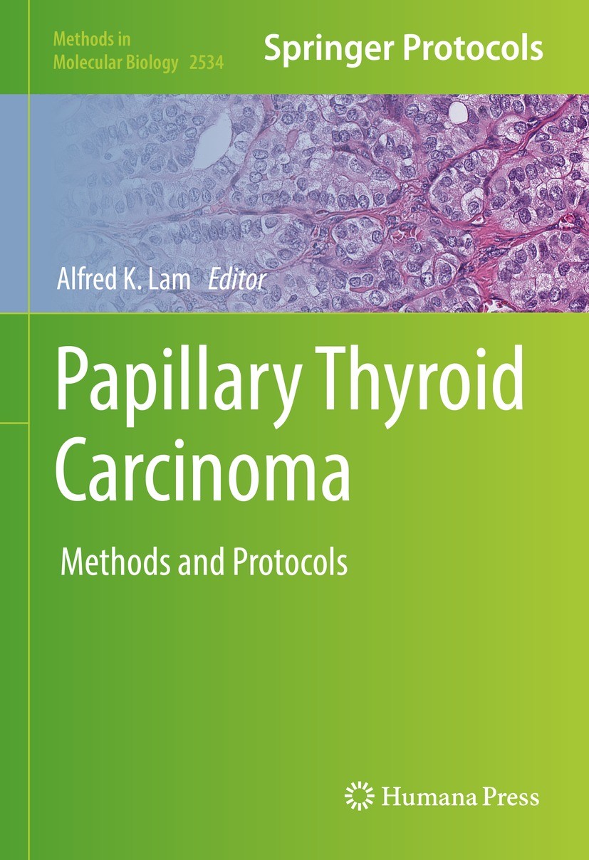 Titlebook: Papillary Thyroid Carcinoma; Methods and Protocol Alfred K. Lam Book 2022 The Editor(s) (if applicable) and The Author(s), under exclusive Titlebook: Papillary Thyroid Carcinoma; Methods and Protocol Alfred K. Lam Book 2022 The Editor(s) (if applicable) and The Author(s), under exclusive
