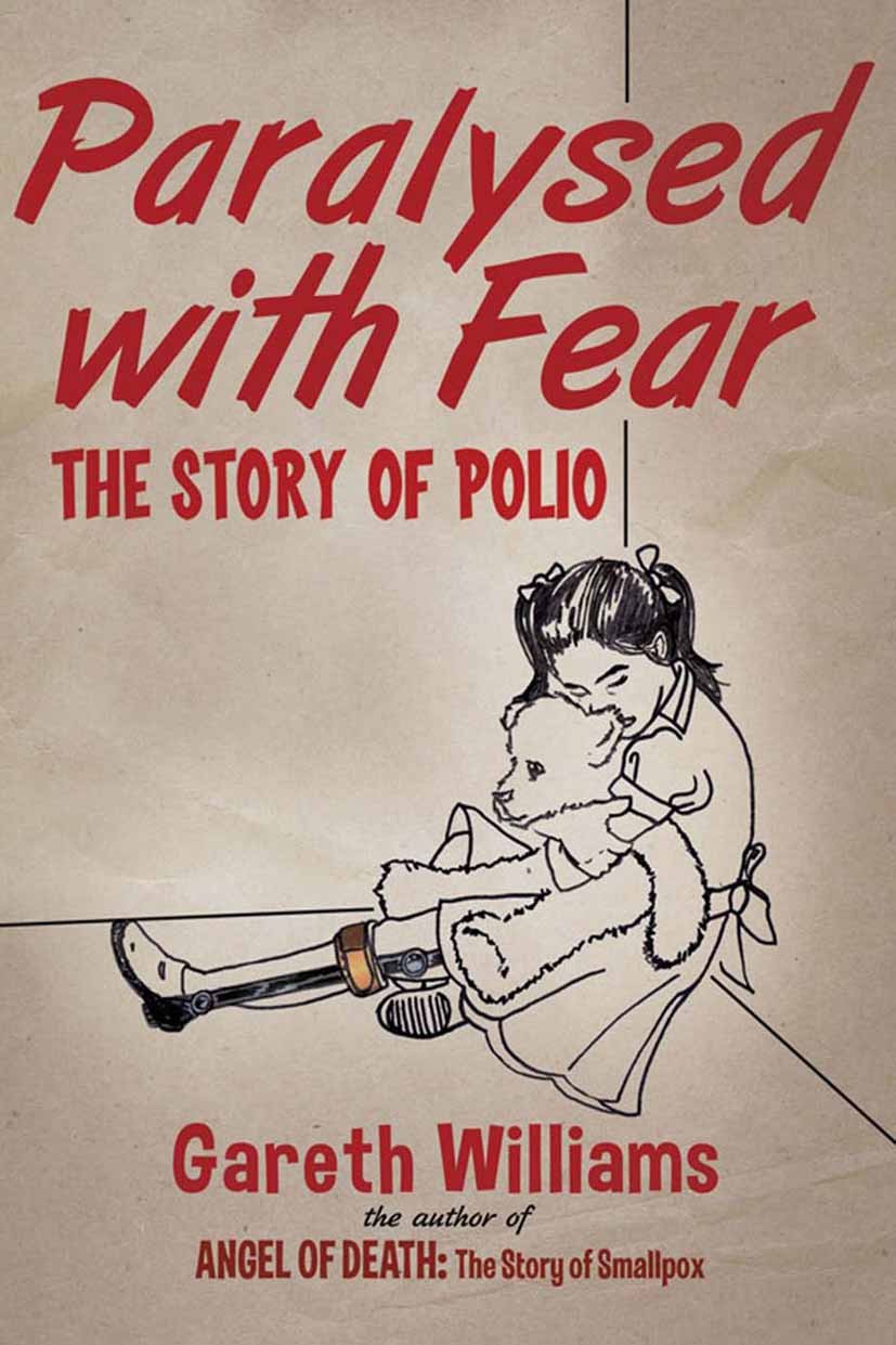 Titlebook: Paralysed with Fear; The Story of Polio Gareth Williams Book 2013 Palgrave Macmillan, a division of Macmillan Publishers Limited 2013 Histo Titlebook: Paralysed with Fear; The Story of Polio Gareth Williams Book 2013 Palgrave Macmillan, a division of Macmillan Publishers Limited 2013 Histo