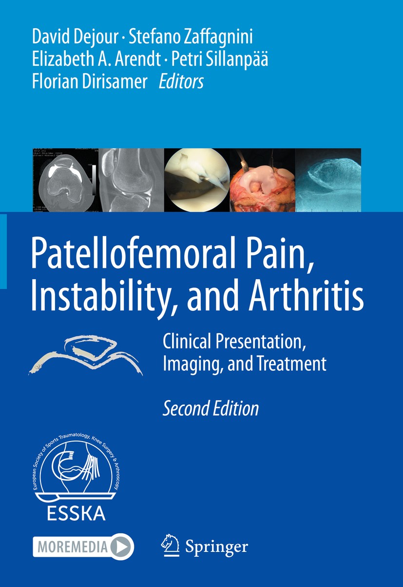 Titlebook: Patellofemoral Pain, Instability, and Arthritis; Clinical Presentatio David Dejour,Stefano Zaffagnini,Florian Dirisamer Book 2020Latest edi Titlebook: Patellofemoral Pain, Instability, and Arthritis; Clinical Presentatio David Dejour,Stefano Zaffagnini,Florian Dirisamer Book 2020Latest edi