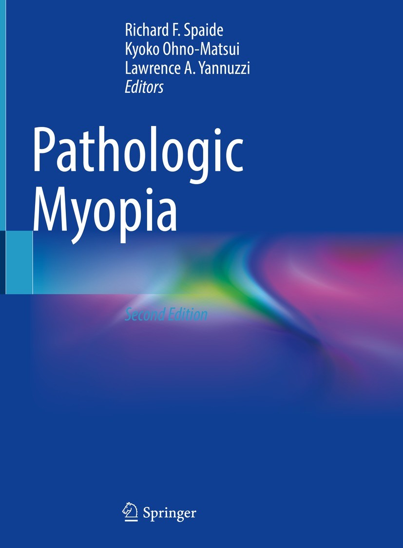 Titlebook: Pathologic Myopia; Richard F. Spaide,Kyoko Ohno-Matsui,Lawrence A. Ya Book 2021Latest edition Springer Nature Switzerland AG 2021 cataract Titlebook: Pathologic Myopia; Richard F. Spaide,Kyoko Ohno-Matsui,Lawrence A. Ya Book 2021Latest edition Springer Nature Switzerland AG 2021 cataract
