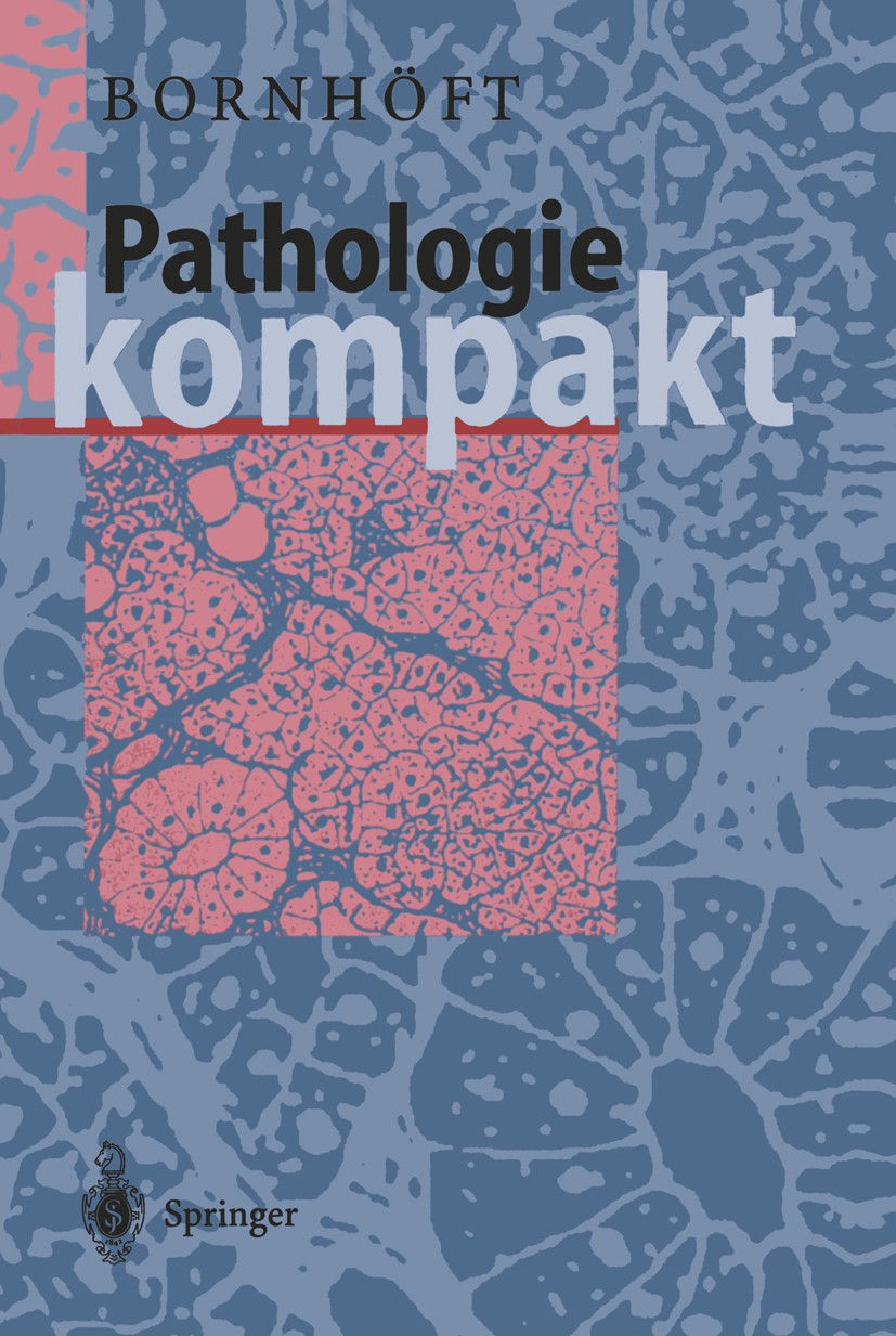 Titlebook: Pathologie Kompakt; Gudrun Bornhöft Book 1997 Springer-Verlag Berlin Heidelberg 1997 AIDS.Gewebe.Haut.Histopathologie.Knochenmark.Patholog Titlebook: Pathologie Kompakt; Gudrun Bornhöft Book 1997 Springer-Verlag Berlin Heidelberg 1997 AIDS.Gewebe.Haut.Histopathologie.Knochenmark.Patholog