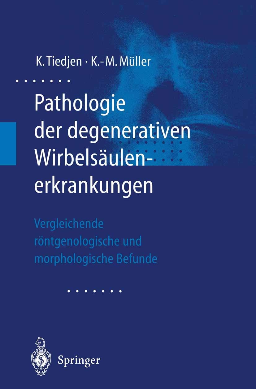 Titlebook: Pathologie der degenerativen Wirbelsäulenerkrankungen; Vergleichende röntge Kay Tiedjen,Klaus-Michael Müller Book 2001 Springer-Verlag Berl Titlebook: Pathologie der degenerativen Wirbelsäulenerkrankungen; Vergleichende röntge Kay Tiedjen,Klaus-Michael Müller Book 2001 Springer-Verlag Berl
