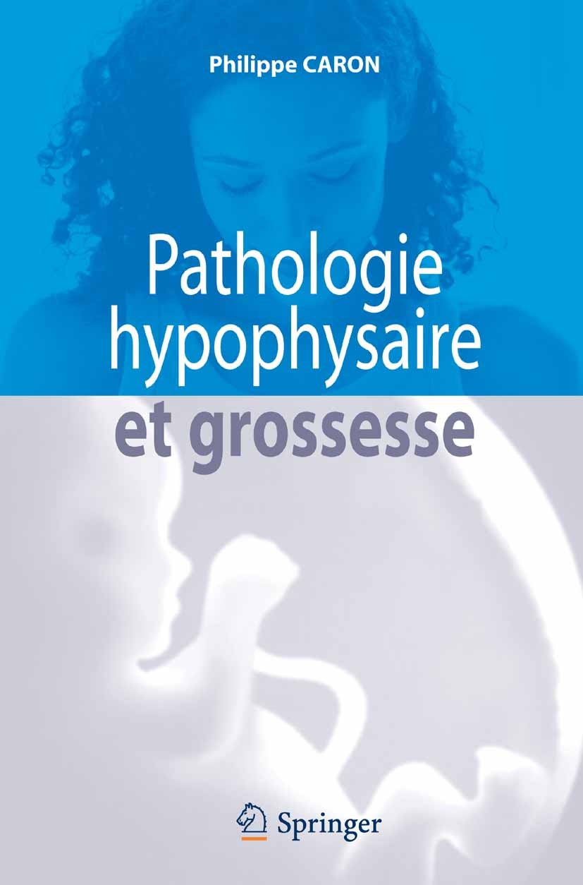 Titlebook: Pathologie hypophysaire et grossesse; Philippe Caron Book 2007Latest edition Springer-Verlag Paris 2007 Acromégalie.Cushing.Diabète insipi Titlebook: Pathologie hypophysaire et grossesse; Philippe Caron Book 2007Latest edition Springer-Verlag Paris 2007 Acromégalie.Cushing.Diabète insipi