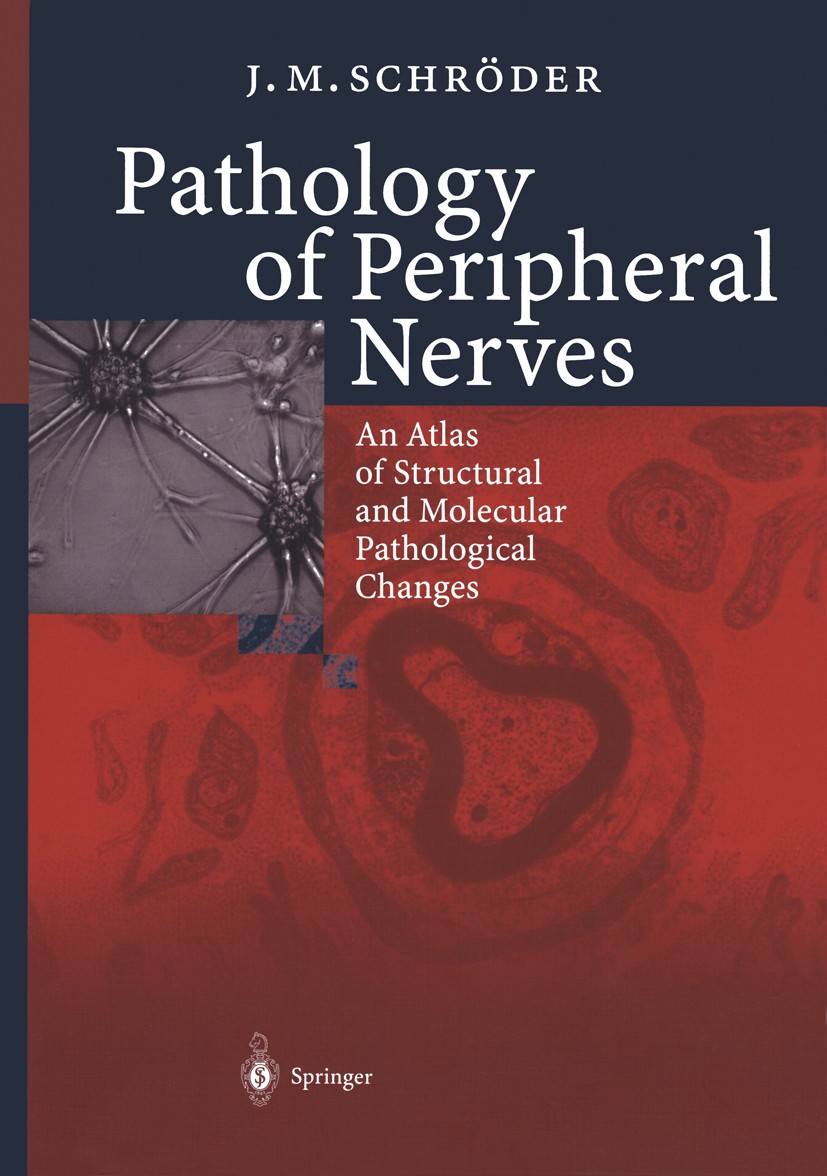 Titlebook: Pathology of Peripheral Nerves; An Atlas of Structur J. M. Schröder Book 2001 Springer-Verlag Berlin Heidelberg 2001 Nervous System.Neurolo Titlebook: Pathology of Peripheral Nerves; An Atlas of Structur J. M. Schröder Book 2001 Springer-Verlag Berlin Heidelberg 2001 Nervous System.Neurolo