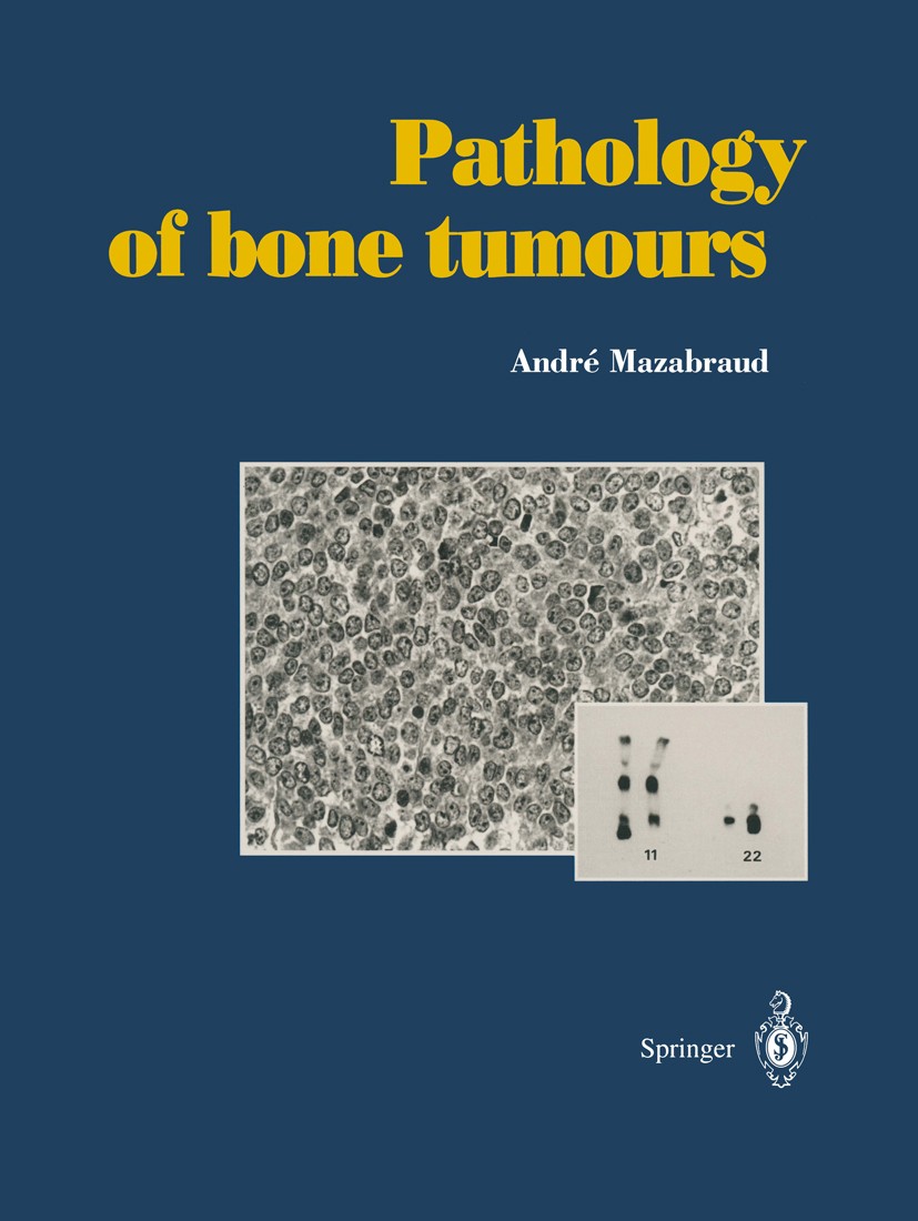 Titlebook: Pathology of bone tumours; Personal experience André Mazabraud Book 1998 Springer-Verlag Berlin Heidelberg 1998 Tumor.aneurysm.bone.bone tu Titlebook: Pathology of bone tumours; Personal experience André Mazabraud Book 1998 Springer-Verlag Berlin Heidelberg 1998 Tumor.aneurysm.bone.bone tu