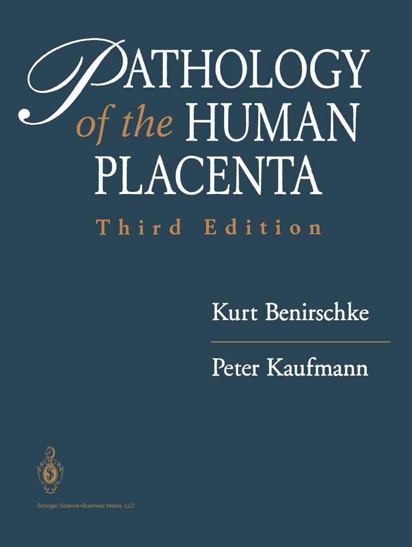 Titlebook: Pathology of the Human Placenta; Kurt Benirschke,Peter Kaufmann Book 19953rd edition Springer-Verlag New York 1995 anatomy.carcinoma.cell. Titlebook: Pathology of the Human Placenta; Kurt Benirschke,Peter Kaufmann Book 19953rd edition Springer-Verlag New York 1995 anatomy.carcinoma.cell.