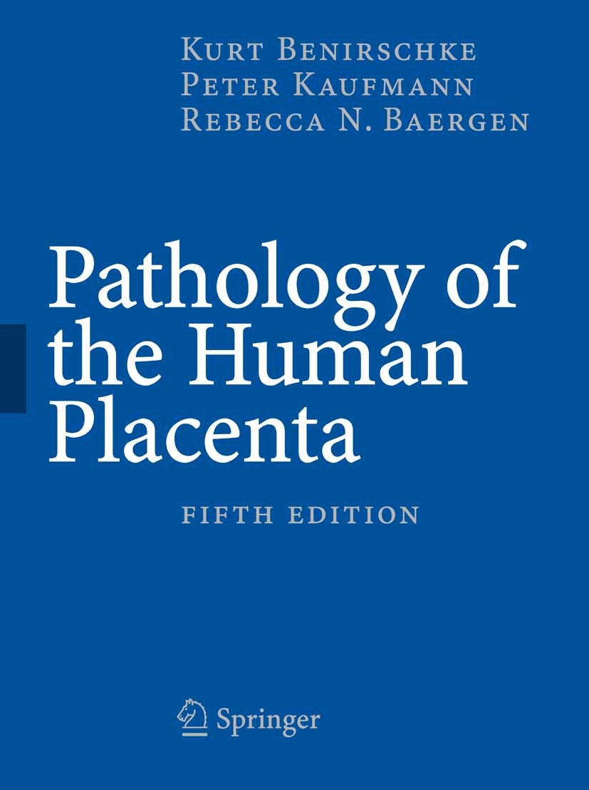 Titlebook: Pathology of the Human Placenta, 5th Edition; Kurt Benirschke,Peter Kaufmann,Rebecca Baergen Book 20065th edition Springer-Verlag New York Titlebook: Pathology of the Human Placenta, 5th Edition; Kurt Benirschke,Peter Kaufmann,Rebecca Baergen Book 20065th edition Springer-Verlag New York