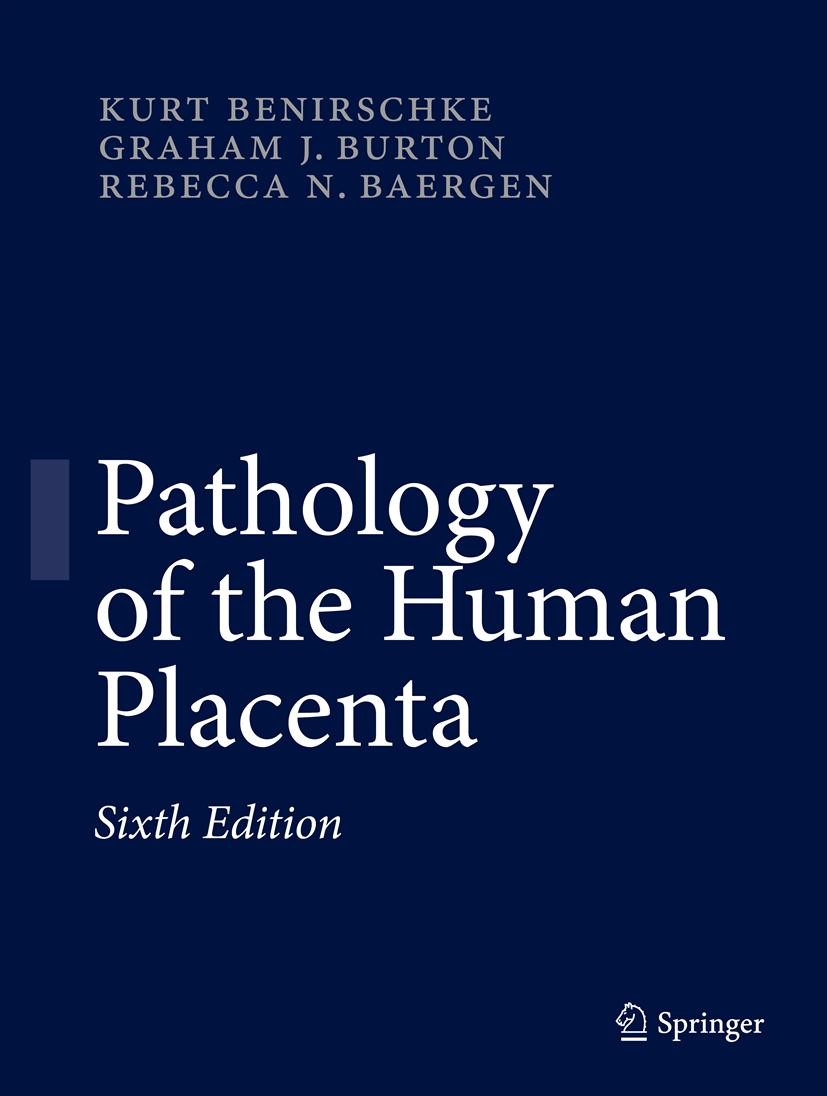 Titlebook: Pathology of the Human Placenta; Kurt Benirschke,Graham J. Burton,Rebecca N Baergen Book 20126th edition Springer-Verlag Berlin Heidelberg Titlebook: Pathology of the Human Placenta; Kurt Benirschke,Graham J. Burton,Rebecca N Baergen Book 20126th edition Springer-Verlag Berlin Heidelberg