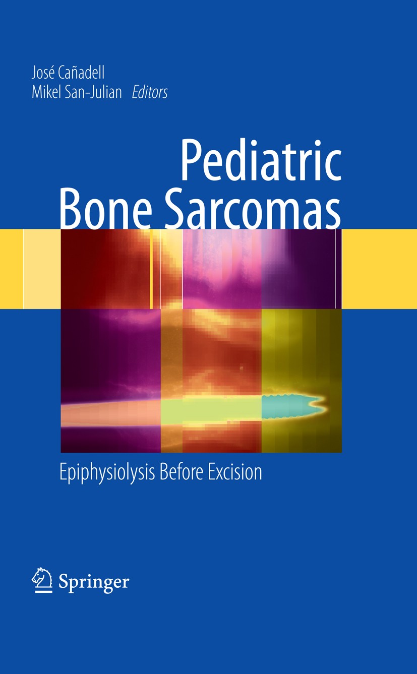 Titlebook: Pediatric Bone Sarcomas; Epiphysiolysis befor Mikel San-Julian,José Cañadell Book 20091st edition Springer-Verlag London 2009 bone.growth.i Titlebook: Pediatric Bone Sarcomas; Epiphysiolysis befor Mikel San-Julian,José Cañadell Book 20091st edition Springer-Verlag London 2009 bone.growth.i