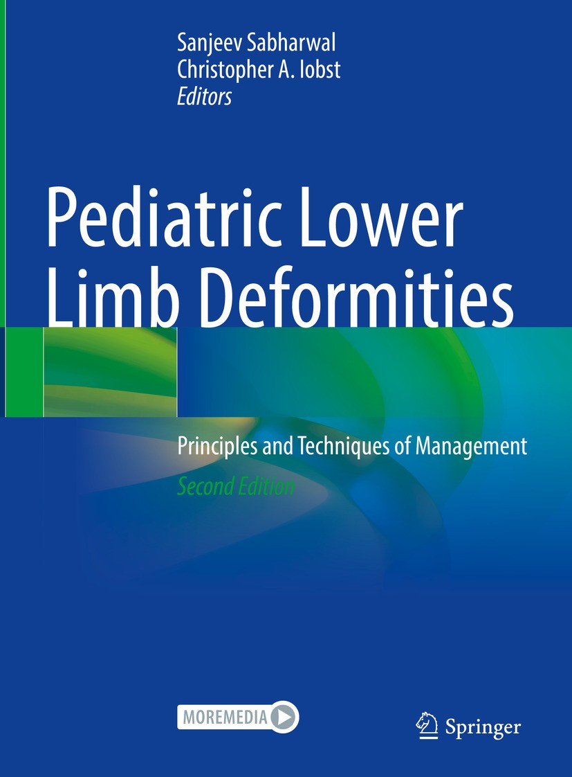 Titlebook: Pediatric Lower Limb Deformities; Principles and Techn Sanjeev Sabharwal,Christopher A. Iobst Book 2024Latest edition The Editor(s) (if app Titlebook: Pediatric Lower Limb Deformities; Principles and Techn Sanjeev Sabharwal,Christopher A. Iobst Book 2024Latest edition The Editor(s) (if app