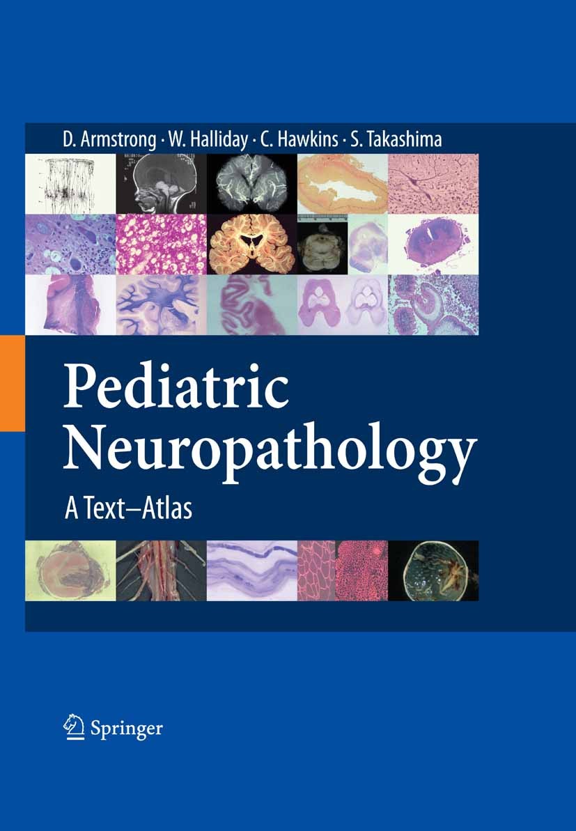 Titlebook: Pediatric Neuropathology; A Text-Atlas Dawna Armstrong,William Halliday,Sachio Takashima Book 2007 Springer-Verlag Tokyo 2007 brain.epileps Titlebook: Pediatric Neuropathology; A Text-Atlas Dawna Armstrong,William Halliday,Sachio Takashima Book 2007 Springer-Verlag Tokyo 2007 brain.epileps